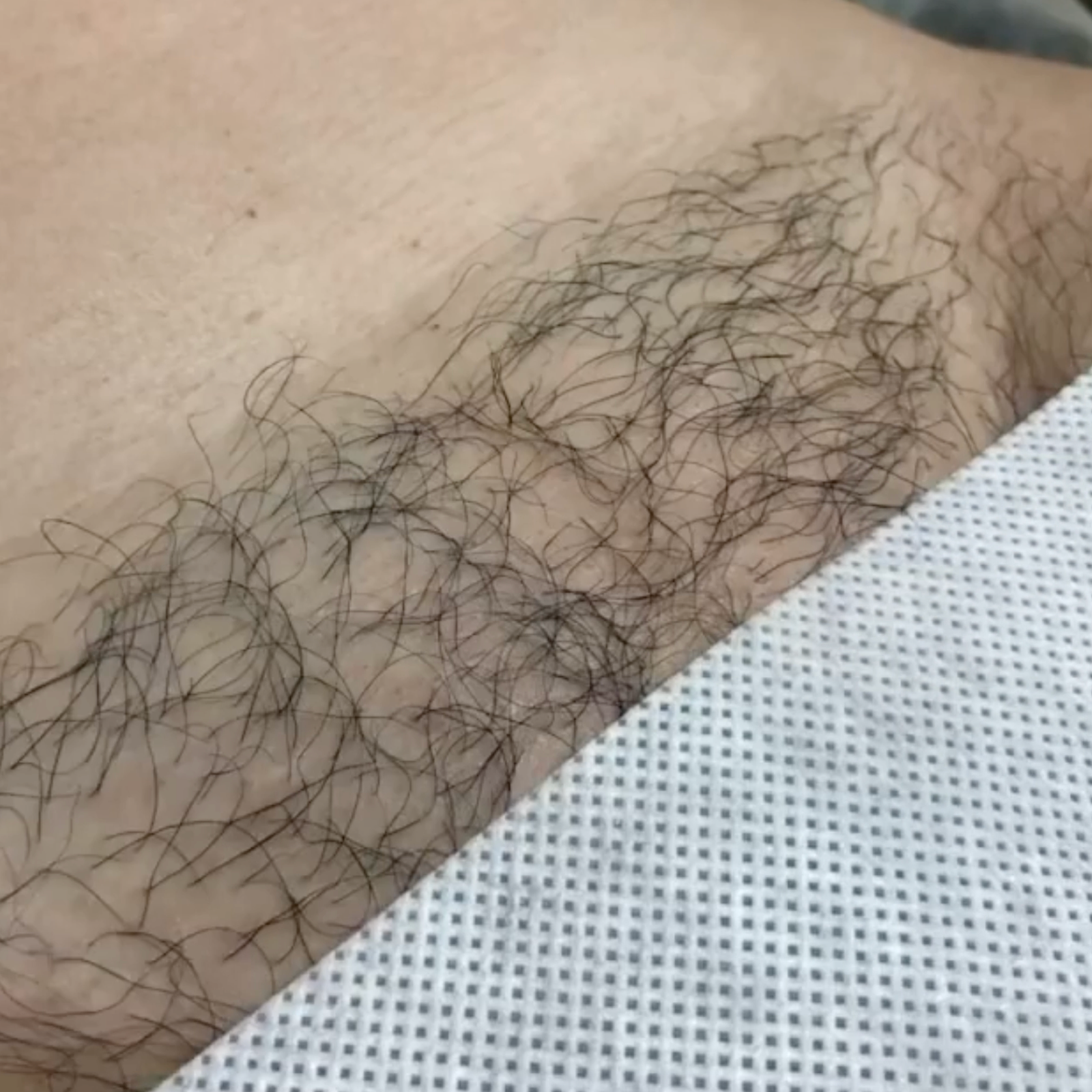 brazilian result - before